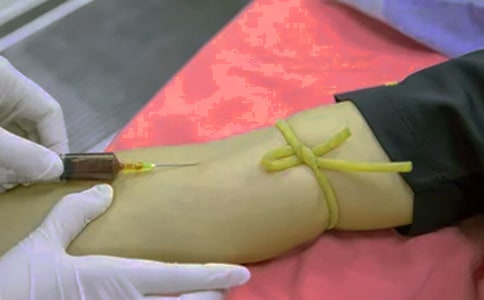 �[�����ߌ�PICC��������ϵK�����c����